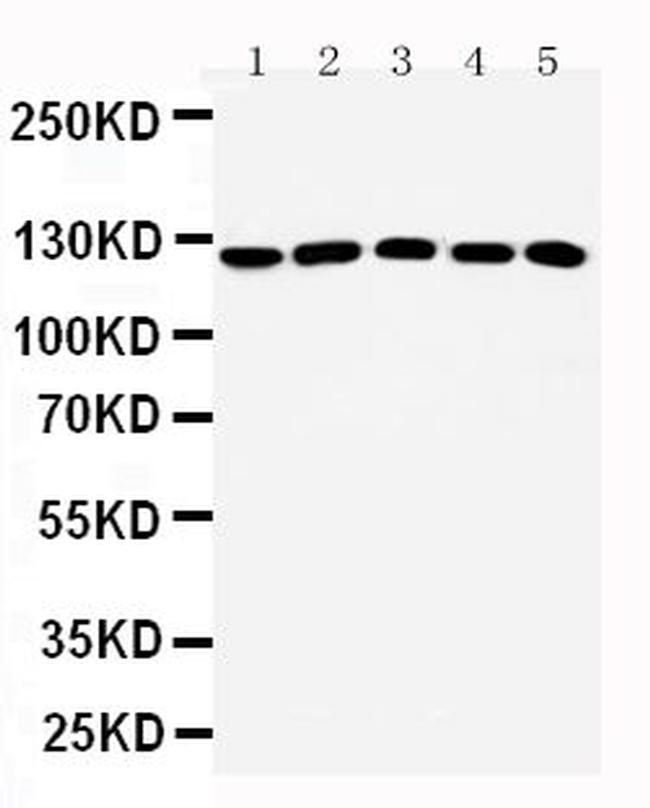 ST5 Antibody in Western Blot (WB)