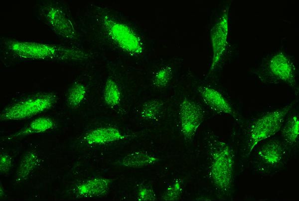 Cofilin Antibody in Immunocytochemistry (ICC/IF)