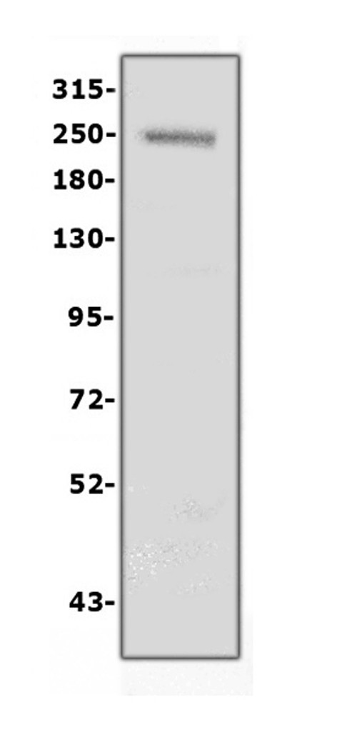 Collagen IV Antibody in Western Blot (WB)