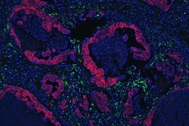 Collagen IV Antibody in Immunohistochemistry (Paraffin) (IHC (P))