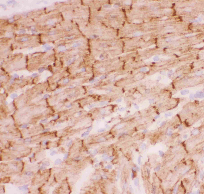 Desmin Antibody in Immunohistochemistry (Frozen) (IHC (F))