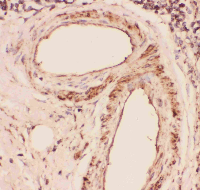 Desmin Antibody in Immunohistochemistry (Paraffin) (IHC (P))