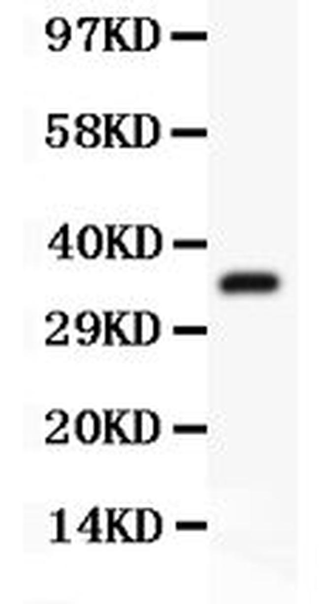 Desmin Antibody in Western Blot (WB)