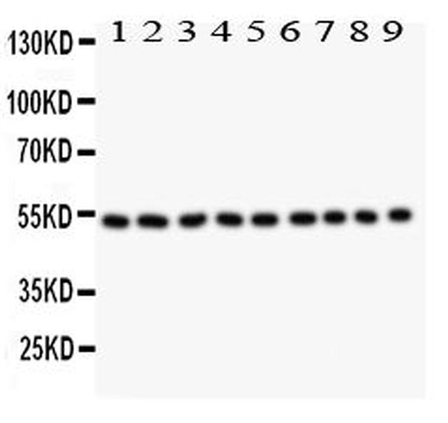 Desmin Antibody in Western Blot (WB)