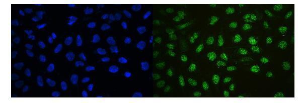 Ku70 Antibody in Immunocytochemistry (ICC/IF)