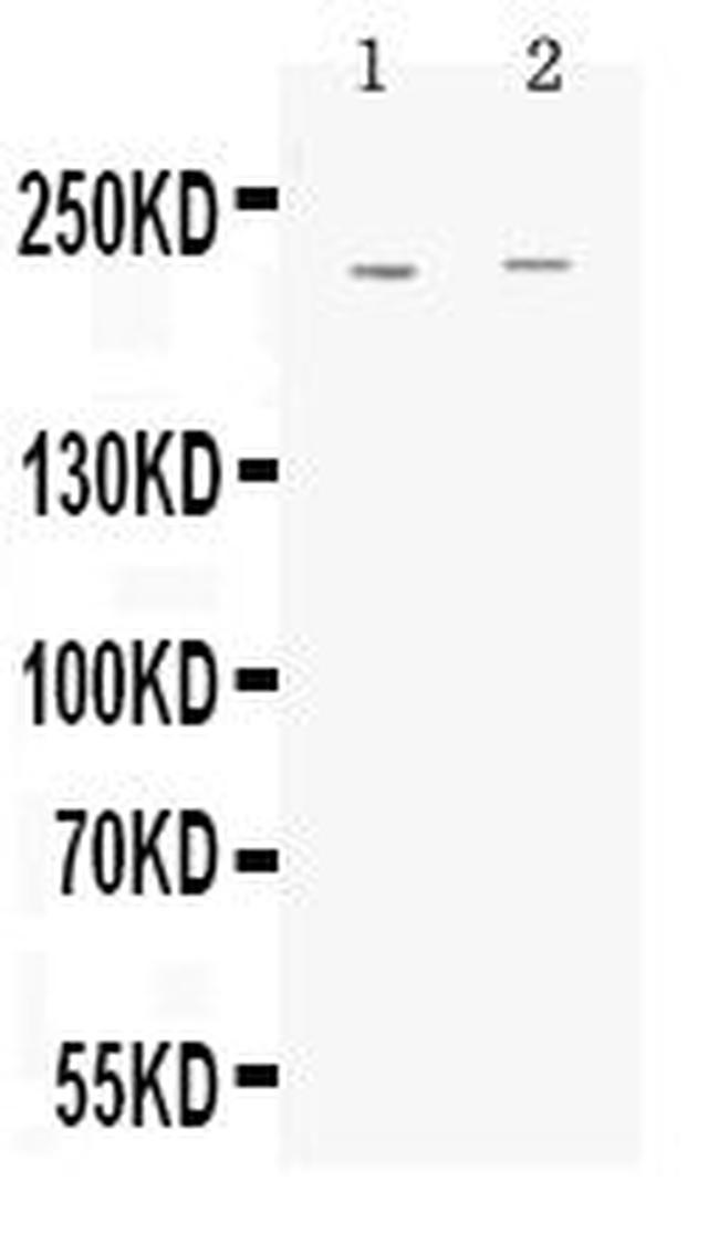 MRP1 Antibody in Western Blot (WB)