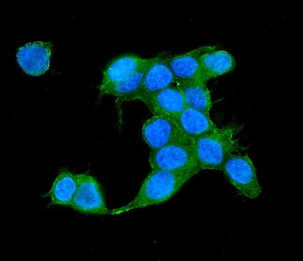 IQGAP2 Antibody in Immunocytochemistry (ICC/IF)