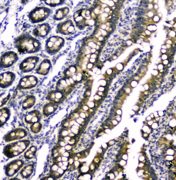 RAB6A Antibody in Immunohistochemistry (Paraffin) (IHC (P))