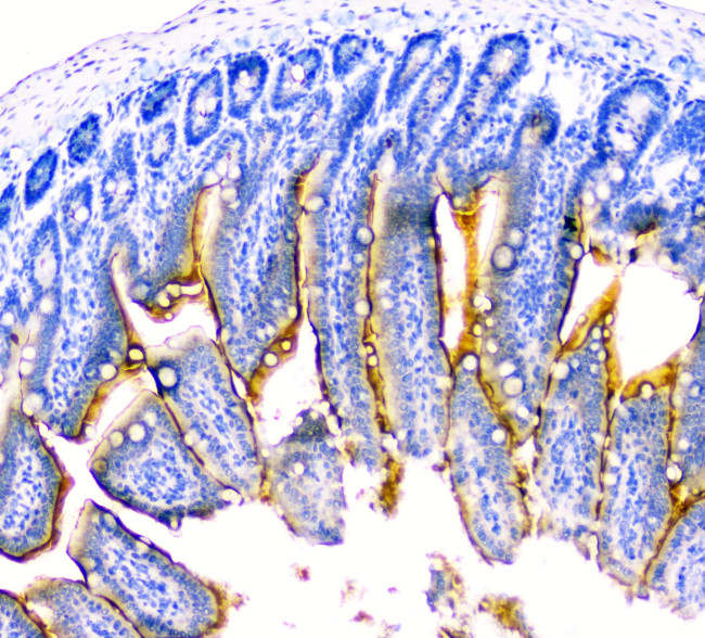 DDR2 Antibody in Immunohistochemistry (Paraffin) (IHC (P))