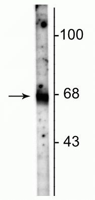 SLC6A1 Antibody in Western Blot (WB)