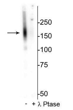 Phospho-SLC12A3 (Thr53) Antibody in Western Blot (WB)