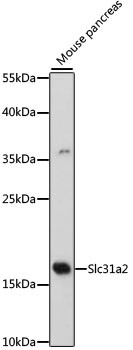 CTR2 Antibody in Western Blot (WB)