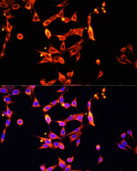 HPa1 Antibody in Immunocytochemistry (ICC/IF)