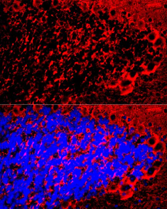 MBP Antibody in Immunocytochemistry (ICC/IF)