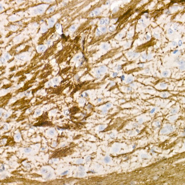 MBP Antibody in Immunohistochemistry (Paraffin) (IHC (P))