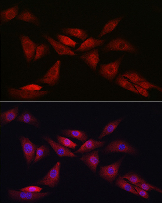 NOTCH1 Antibody in Immunocytochemistry (ICC/IF)