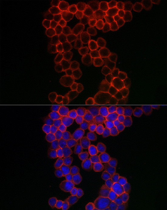 CD38 Antibody in Immunocytochemistry (ICC/IF)