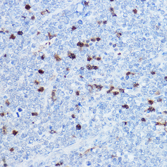 S100A8 Antibody in Immunohistochemistry (Paraffin) (IHC (P))