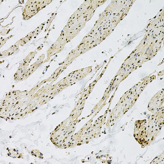 CD9 Antibody in Immunohistochemistry (Paraffin) (IHC (P))