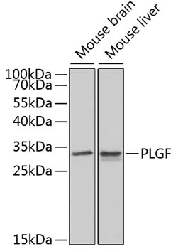 PGF Antibody in Western Blot (WB)