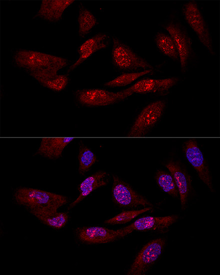 eIF6 Antibody in Immunocytochemistry (ICC/IF)