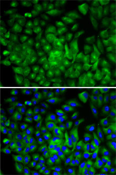 ATG16L1 Antibody in Immunocytochemistry (ICC/IF)