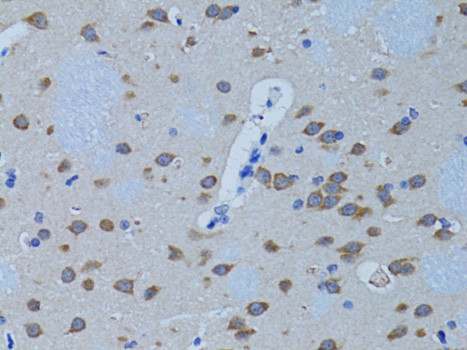 PLCB1 Antibody in Immunohistochemistry (Paraffin) (IHC (P))