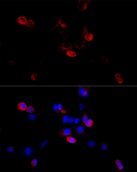 Filamin B Antibody in Immunocytochemistry (ICC/IF)