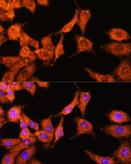 N-WASP Antibody in Immunocytochemistry (ICC/IF)