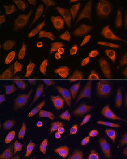 N-WASP Antibody in Immunocytochemistry (ICC/IF)