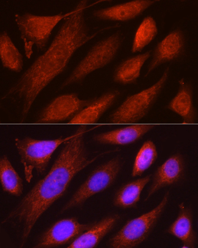 RHOT2 Antibody in Immunocytochemistry (ICC/IF)