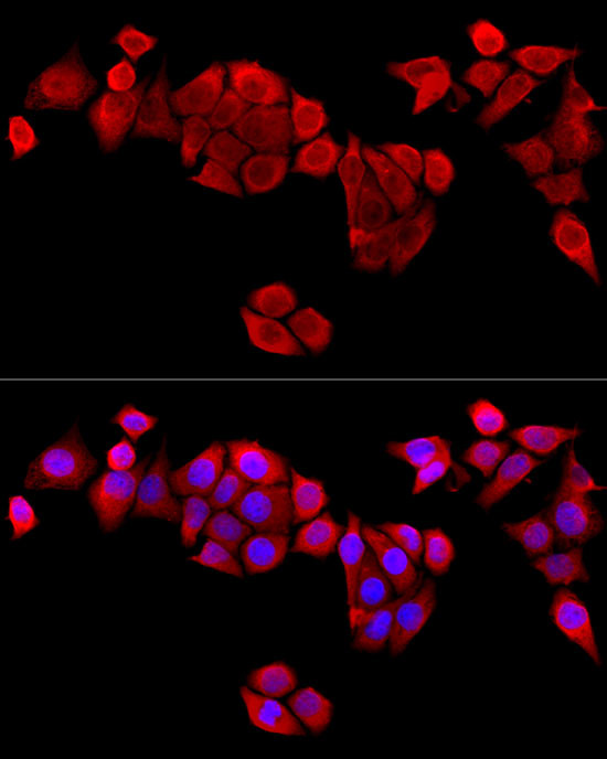 EB1 Antibody in Immunocytochemistry (ICC/IF)