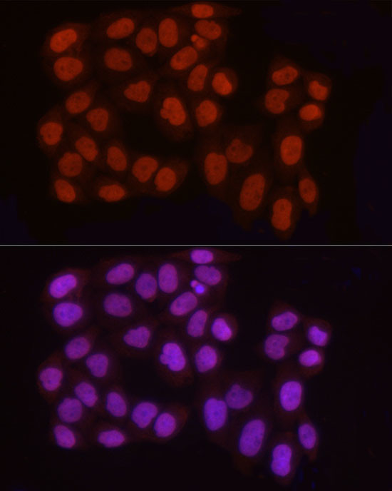 H3R2me2a Antibody in Immunocytochemistry (ICC/IF)