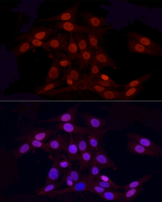 H3R2me2a Antibody in Immunocytochemistry (ICC/IF)