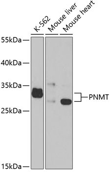 PNMT Antibody in Western Blot (WB)