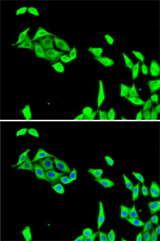 CDK5 Antibody in Immunocytochemistry (ICC/IF)