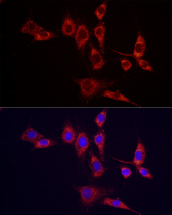 IDH2 Antibody in Immunocytochemistry (ICC/IF)