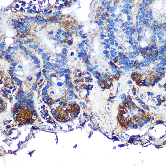 ITLN1 Antibody in Immunohistochemistry (Paraffin) (IHC (P))