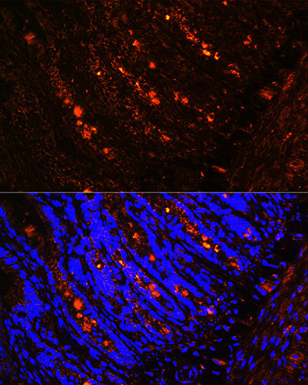 ITLN1 Antibody in Immunohistochemistry (Paraffin) (IHC (P))