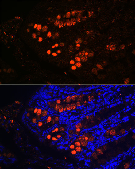 ITLN1 Antibody in Immunohistochemistry (Paraffin) (IHC (P))