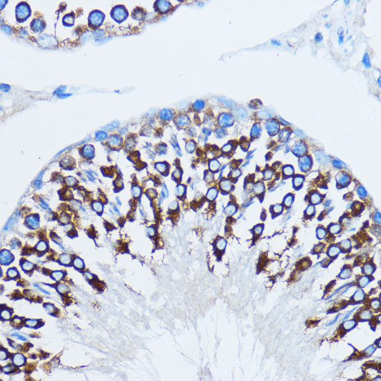 YBX1 Antibody in Immunohistochemistry (Paraffin) (IHC (P))