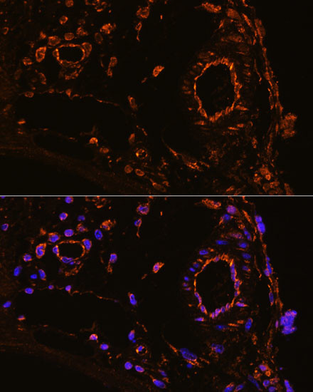 YBX1 Antibody in Immunohistochemistry (Paraffin) (IHC (P))