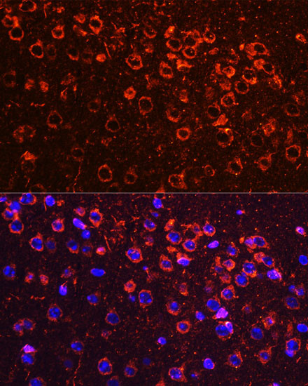 YBX1 Antibody in Immunohistochemistry (Paraffin) (IHC (P))