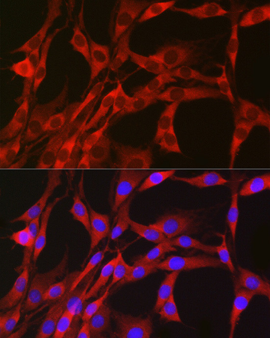 PGD Antibody in Immunocytochemistry (ICC/IF)