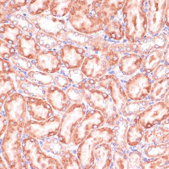 PGD Antibody in Immunohistochemistry (Paraffin) (IHC (P))