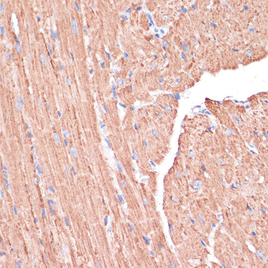 PGD Antibody in Immunohistochemistry (Paraffin) (IHC (P))