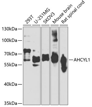 AdoHcyase 2 Antibody in Western Blot (WB)