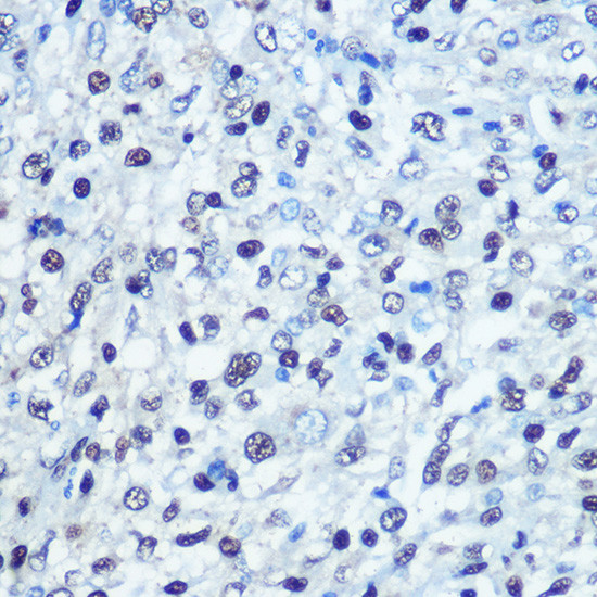 SAMHD1 Antibody in Immunohistochemistry (Paraffin) (IHC (P))