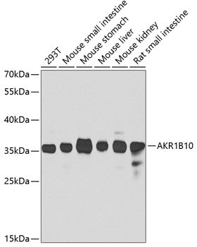 AKR1B10 Antibody in Western Blot (WB)