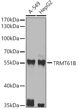 TRMT61B Antibody in Western Blot (WB)